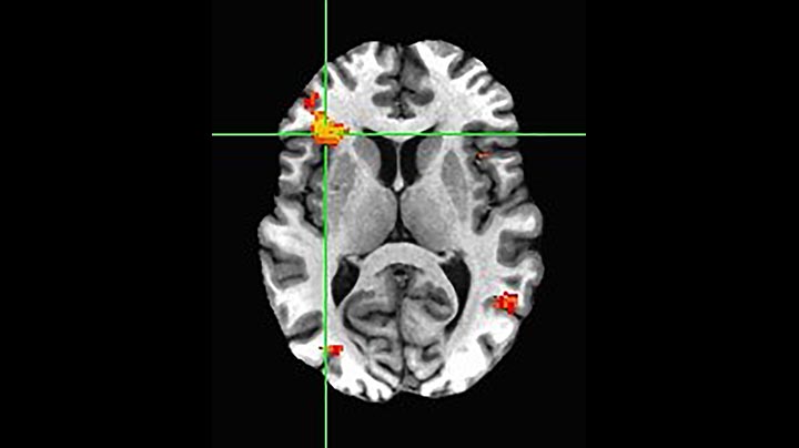 MultiBand SENSE, fMRI matching facial expressions