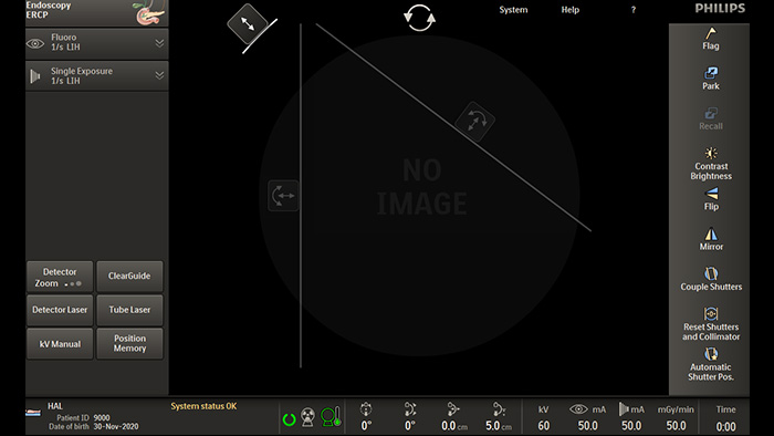 Asymmetric collimation